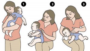 Bebeklerde gaz çıkarma